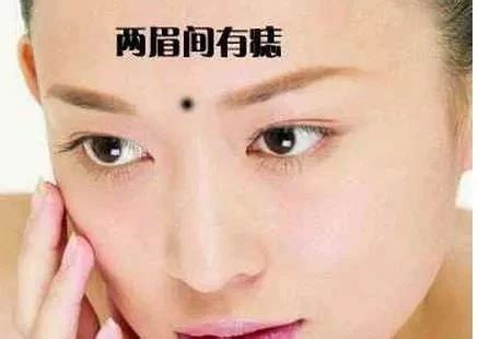 妨夫痣|妨夫痣是什么意思